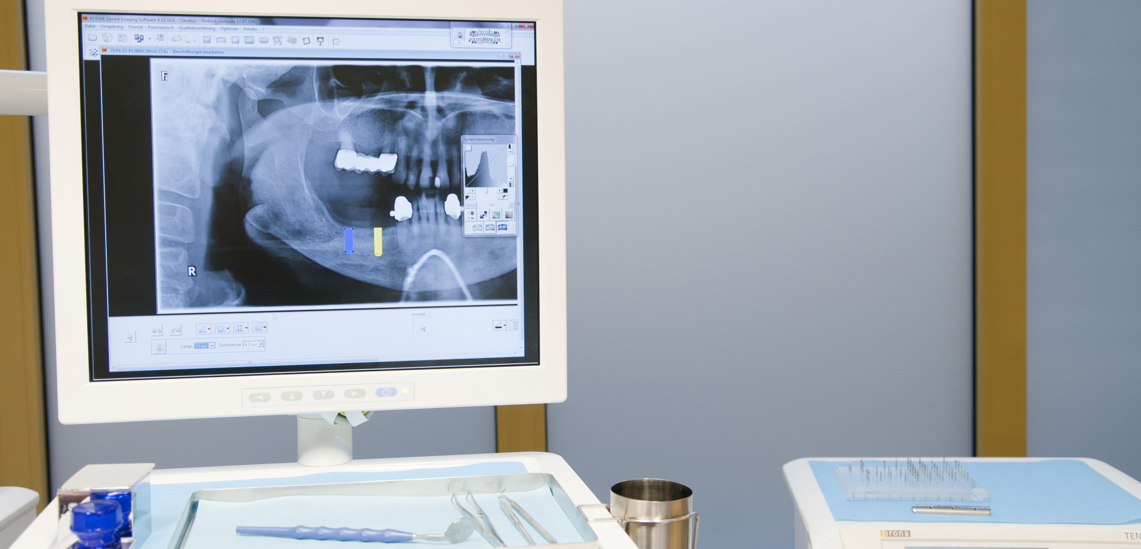Bildschirm zeigt Röntgenbild von Kiefer.